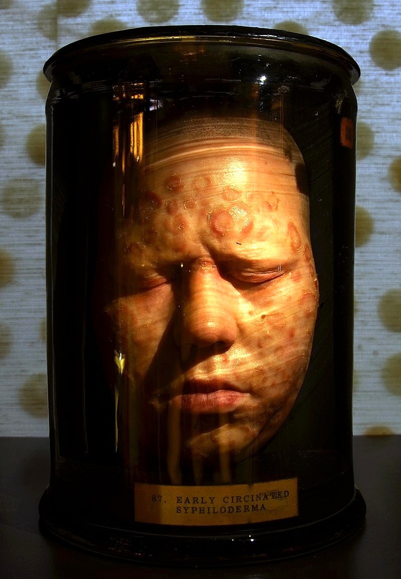 Featured exhibit at Museum of London